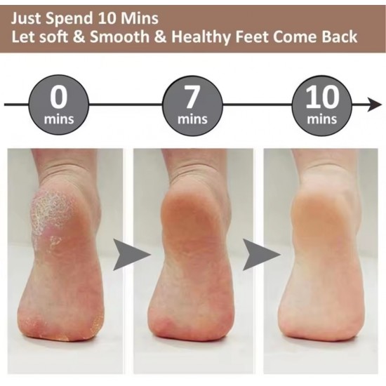 Cordless Pedicure Foot Callus File